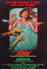 XRay (1981) Free Movie M4ufree