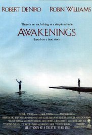 Awakenings (1990) Free Movie